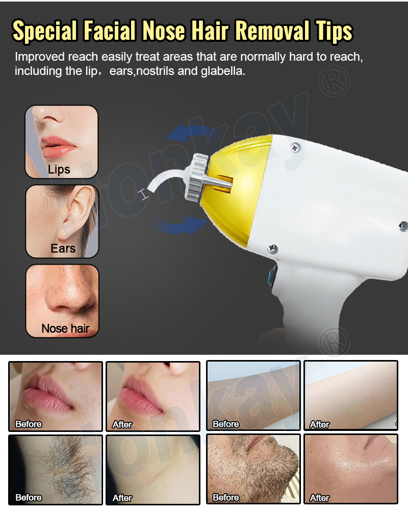 4 in 1 hair removal e-29a detail
